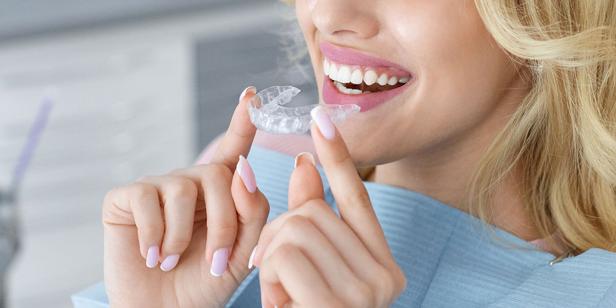 Clear Aligners