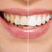 whitening image